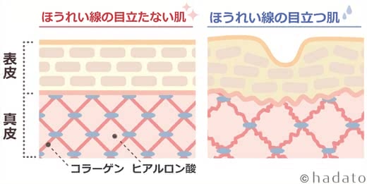 ほうれい線化粧品