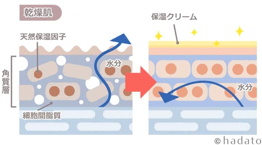 乾燥肌 保湿クリーム