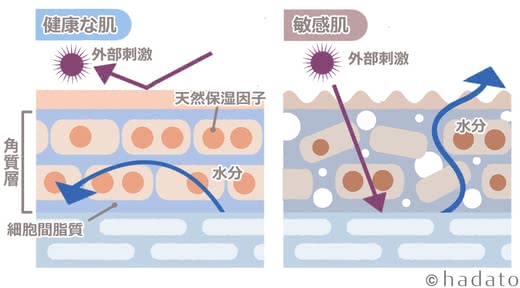 敏感肌